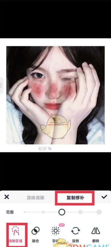 ͼ㸴޲ʹ÷